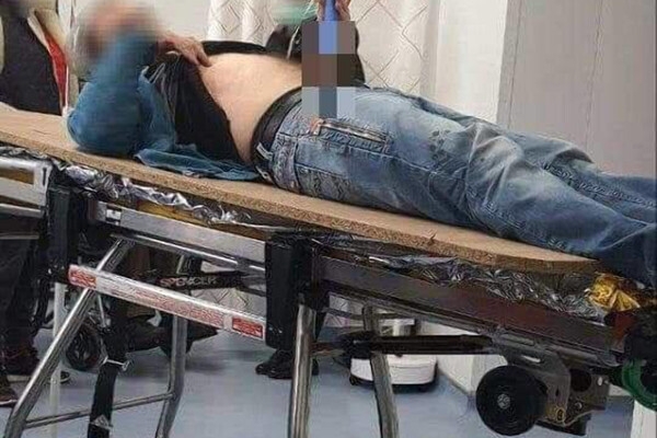 В Одесской области мужчина ударил себя ножом в живот из-за расставания с девушкой 
