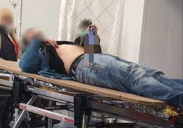 В Одесской области мужчина ударил себя ножом в живот из-за расставания с девушкой 