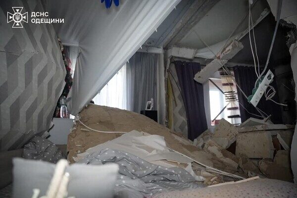 В Одессе из-за возгорания стиральной машинки пострадал мальчик
