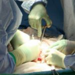 У Миколаєві жінка померла після пластичної операції: деталі трагедії
